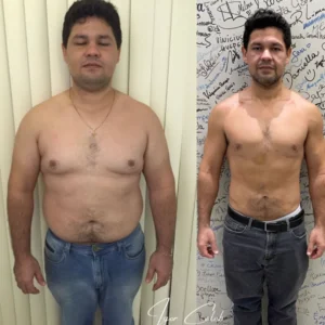 Resultado antes e depois 6